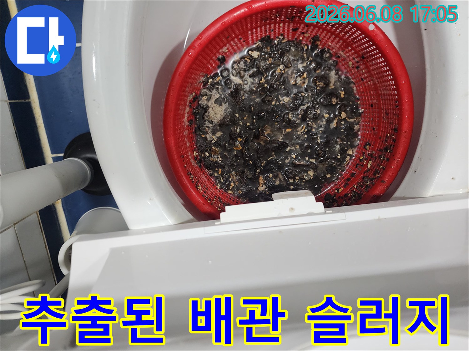 석션 작업으로 뽑아낸 검은색 기름 찌꺼기와 오물들